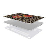 Tropical Cheetah Print | MacBook Case