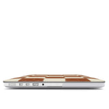 Vintage Tiles | MacBook Case