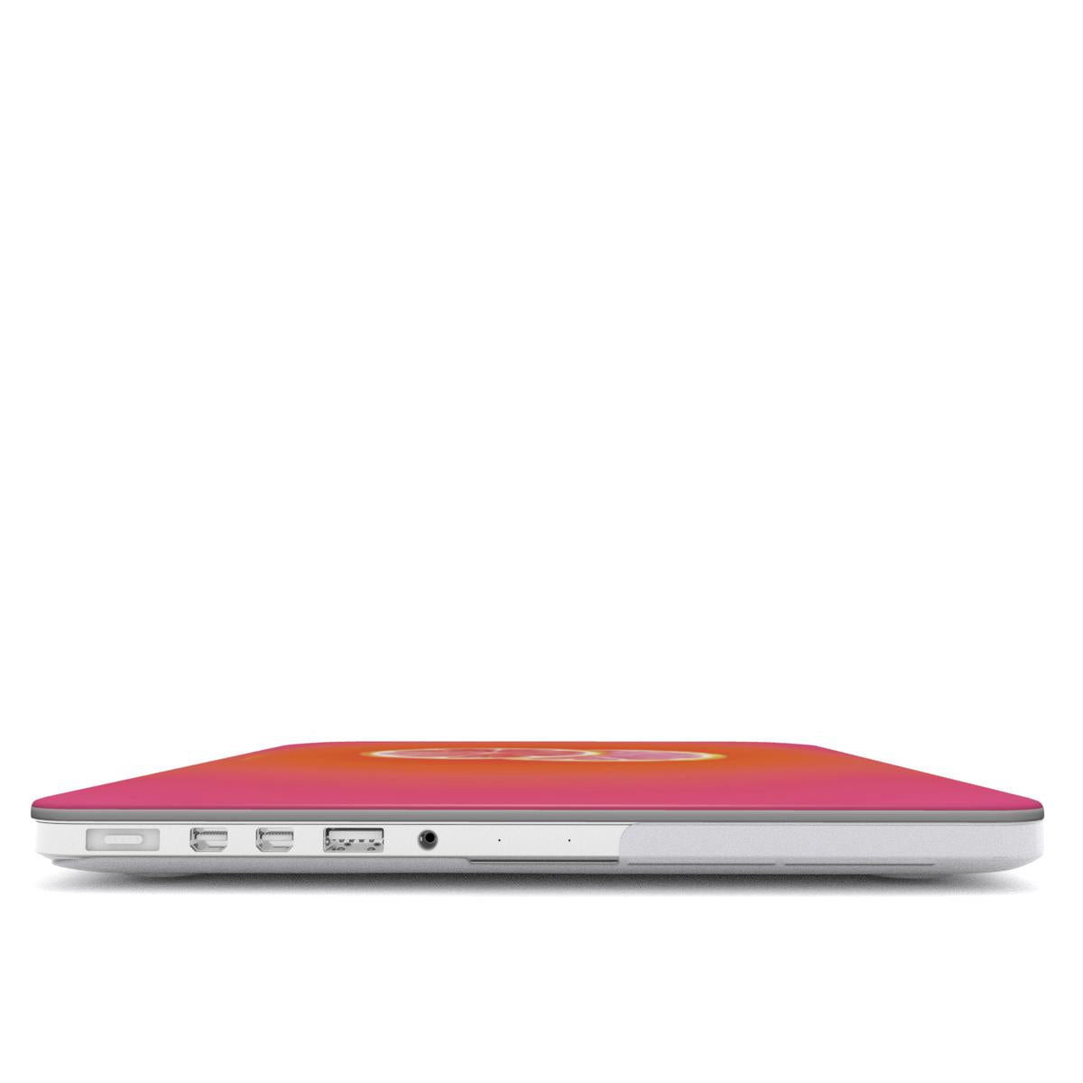 Citrus Crush | MacBook Case
