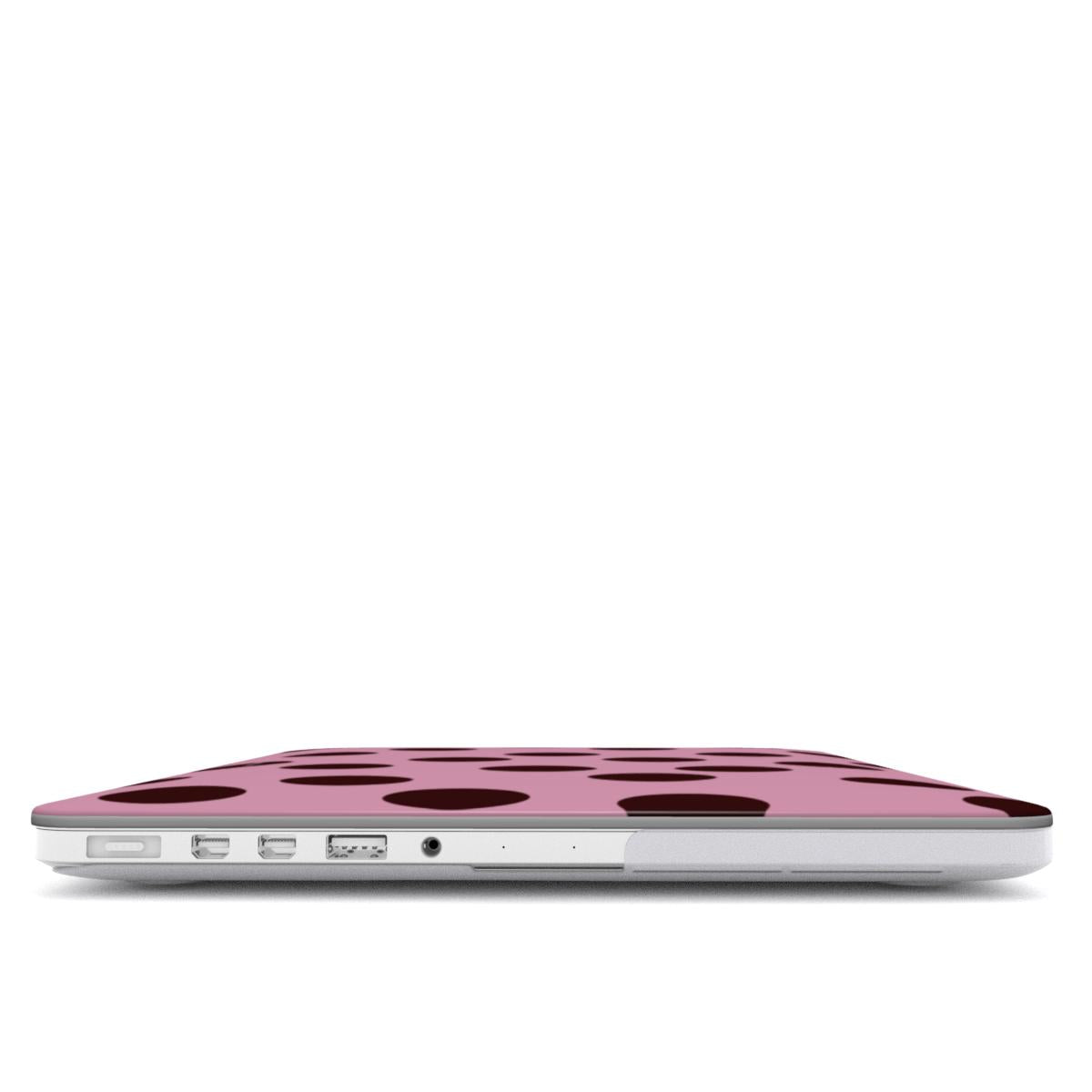 Call Later | MacBook Case