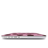 Call Later | MacBook Case