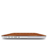 Pumpkin Hypnosis | MacBook Case