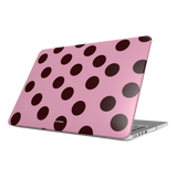 Call Later | MacBook Case